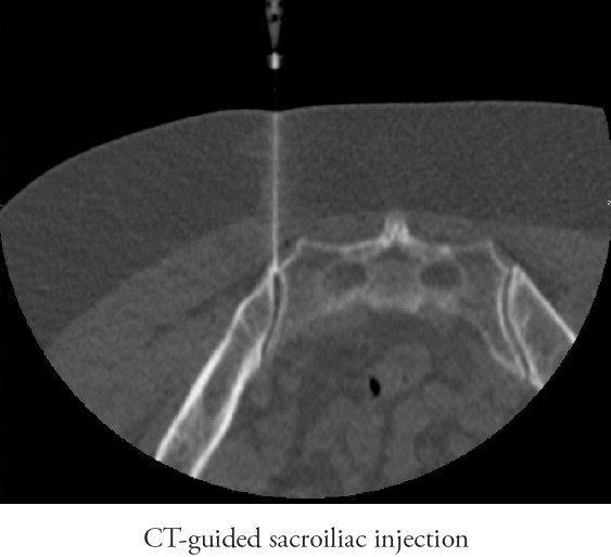 Radia Inc., PS > Patient Info > Exam Descriptions > Pain Relieving